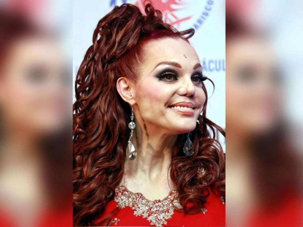 Campuzano vio la luz cuando encontró al cirujano José Achar, quien explicó, se animó a tratar su caso luego de la negativa de decenas de médicos.<br/>