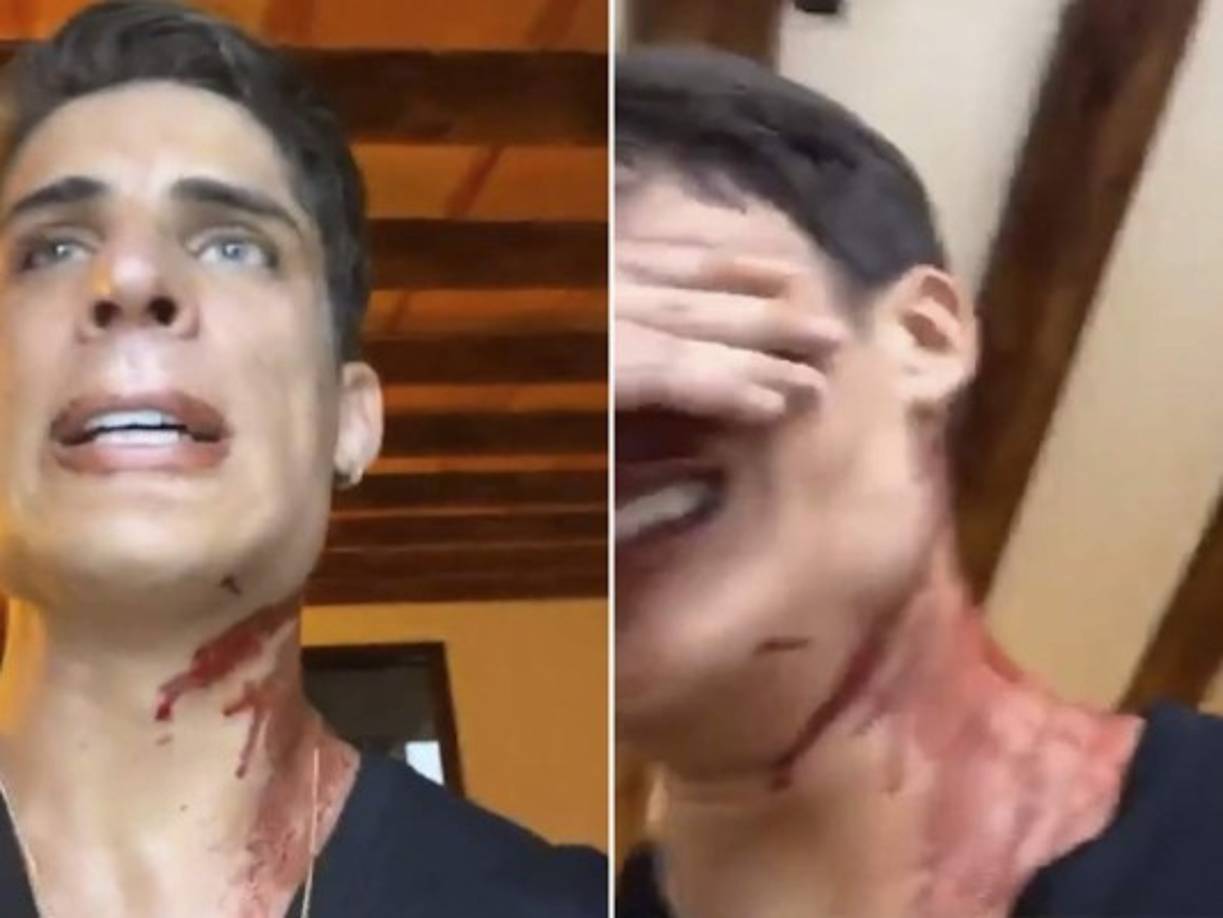 En el video, Tiago Ramos se nota nervioso, agitado, con el rostro desencajado y el cuello ensangrentado mientras explica lo que ha sucedido en el restaurante sin poder entenderlo.