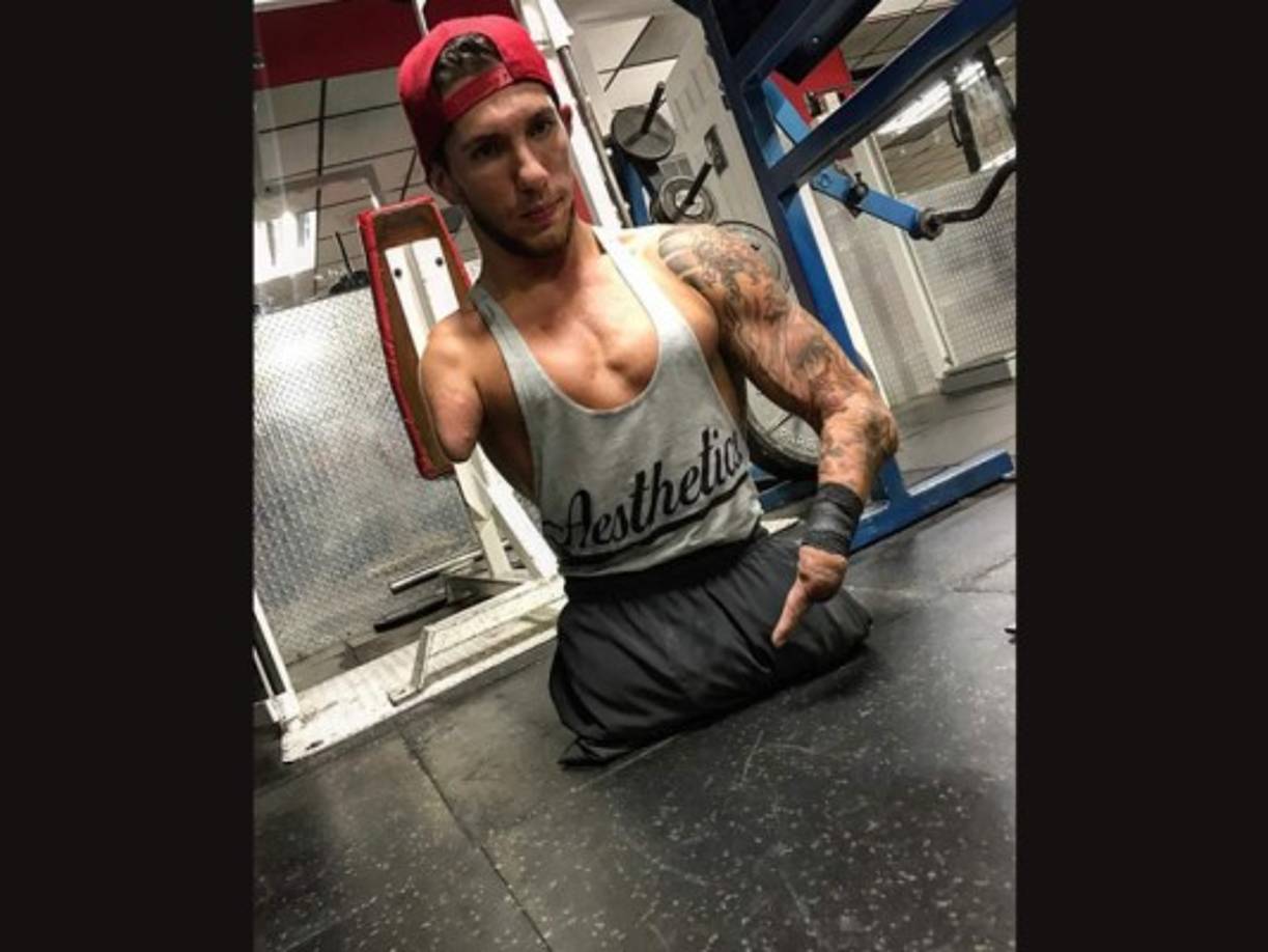 Los doctores le dieron muy pocas probabilidades de vivir, sin embargo ya tiene 21 años de vida.