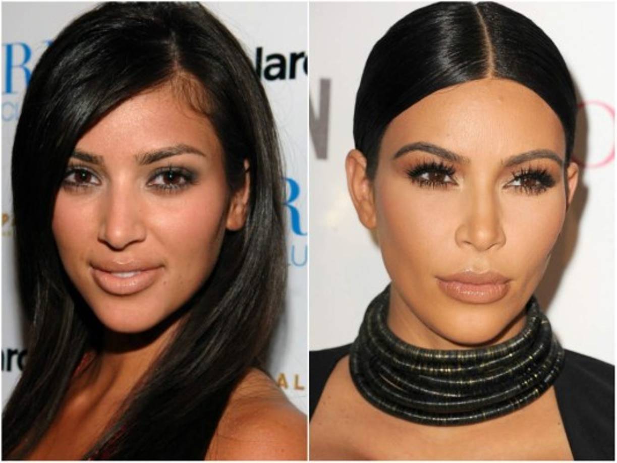 La controversial pero millonaria Kim Kardashian está de cumpleaños. Hoy celebra sus 35 años de edad rodeada de lujos, fama y poder. Así ha cambiado su rostro y así ha esculpido su cuerpo desde el 2006 hasta el 2015.