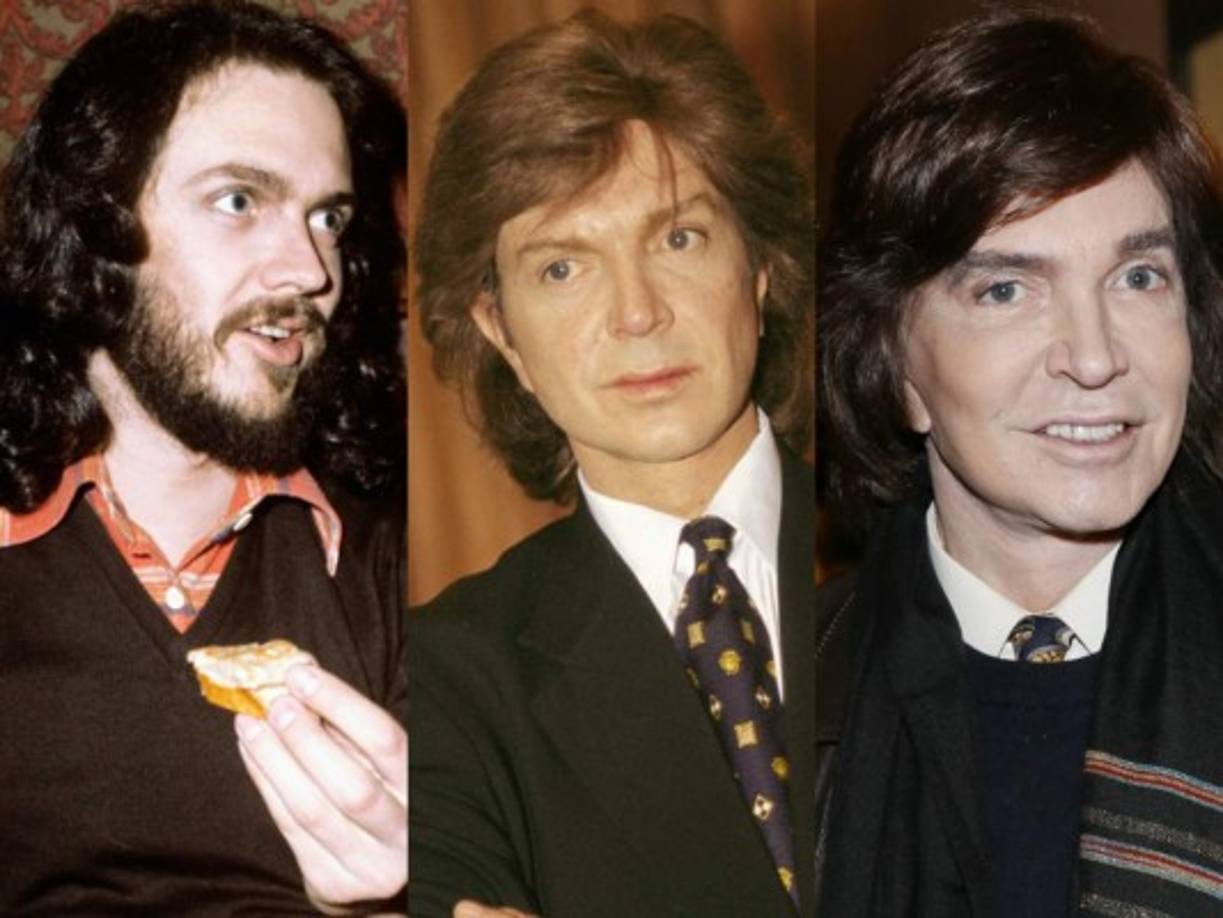 Los diferentes cambios del rostro de Camilo Sesto.