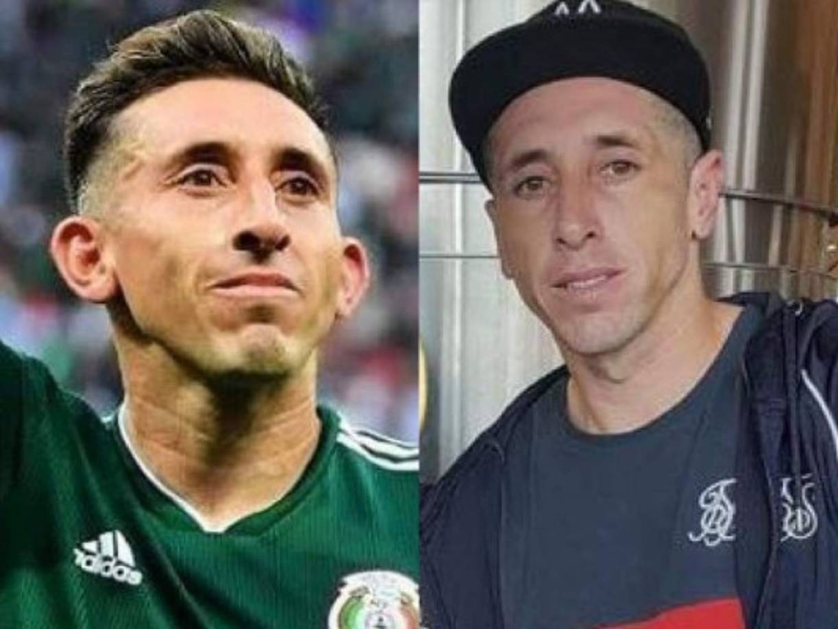 Héctor Herrera recientemente se sometió a una cirugía plástica - una rinoplastia y una otoplastia – y así se ve ahora.