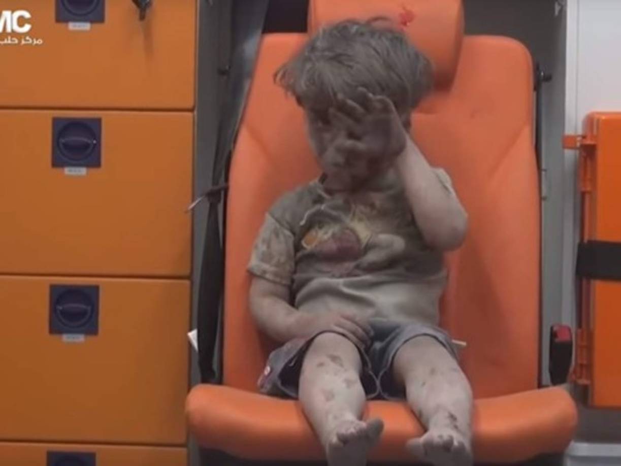 Su cara llena de sangre y polvo, sentado en una silla, descalzo y con un rostro de no entender lo que pasaba, el menor conmovió a nivel mundial.