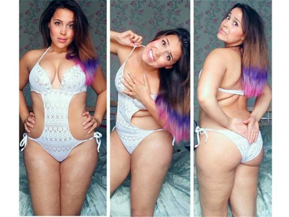 Ahora Megan tiene 22 años y ha compartido su recuperación en Instagram, en donde cuenta su experiencia con la esperanza de ayuda a otras personas que pasan por la misma situación.