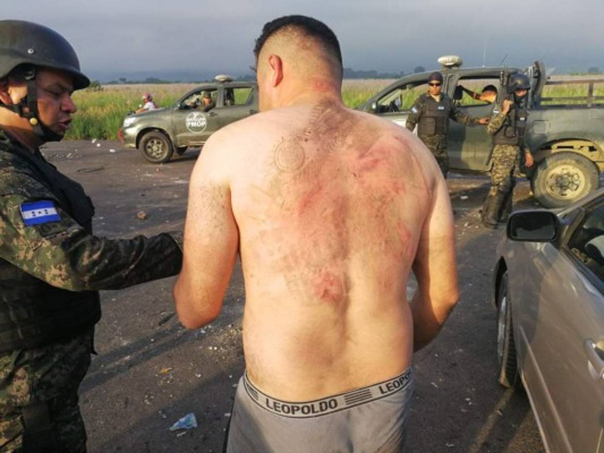 Fuertes golpes recibieron los policías, como se puede apreciar en sus espaldas y demás partes de su cuerpo.