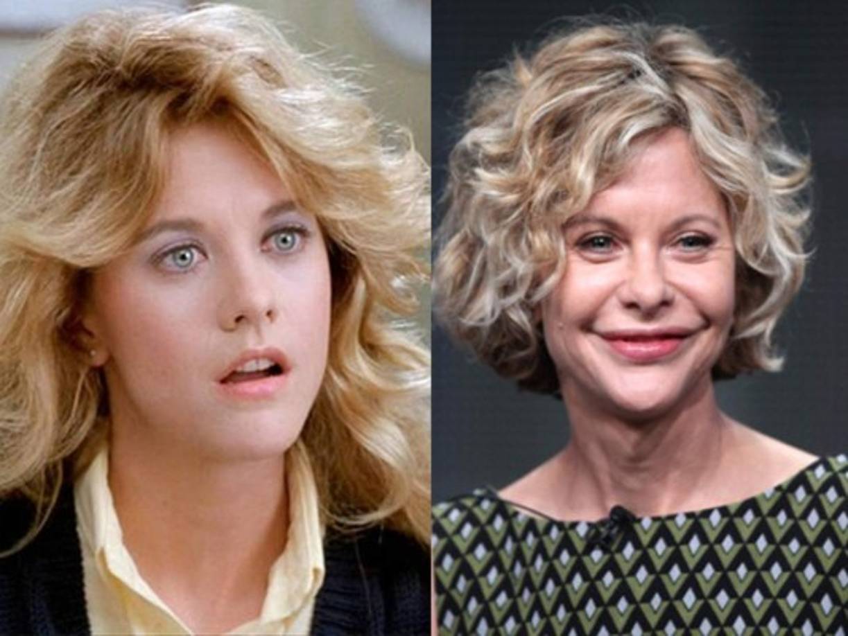 Meg Ryan: La actriz luce irreconocible, de haber sido uno de los símbolos de belleza de los 80 y 90, hoy es el blanco de severas críticas y burlas. Sin embargo, ella niega haber usado bótox o haberse realizado alguna cirugía. A sus 54 años, su rostro no puede pasar desapercibido, atrás quedaron sus años de ser un ángel que enamoraba a todos.<br/>
