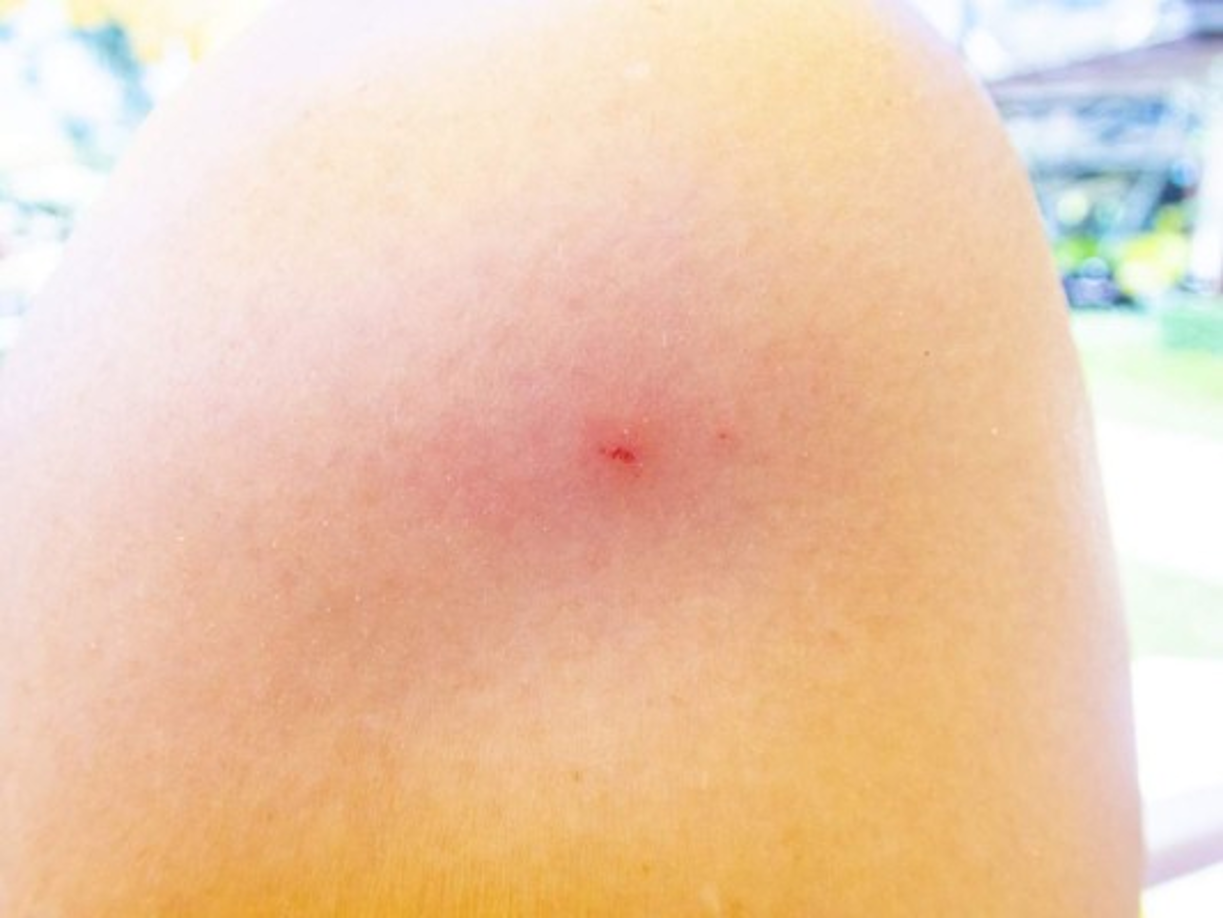 El insecto, conocido como “avispón asesino” y procedente del este de Asia, no es solamente letal para los humanos, sino que podría aniquilar colmenas enteras de abejas en cuestión de horas, y puede luchar contra presas del doble de su tamaño.<br/><br/><br/>