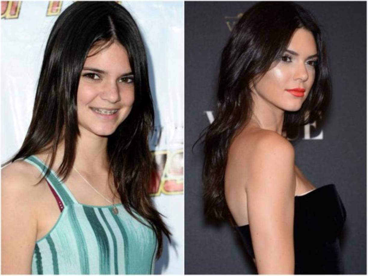 Kendall era pequeña cuando su familia se hizo famosa y, a partir de allí, inició su carrera como modelo.
