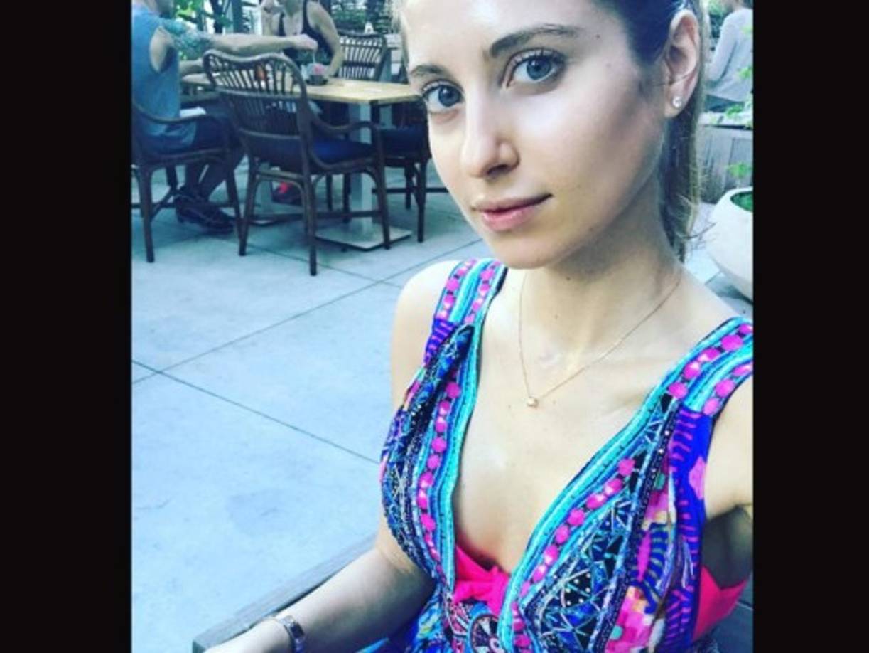 Así lucía la modelo en semanas anteriores.