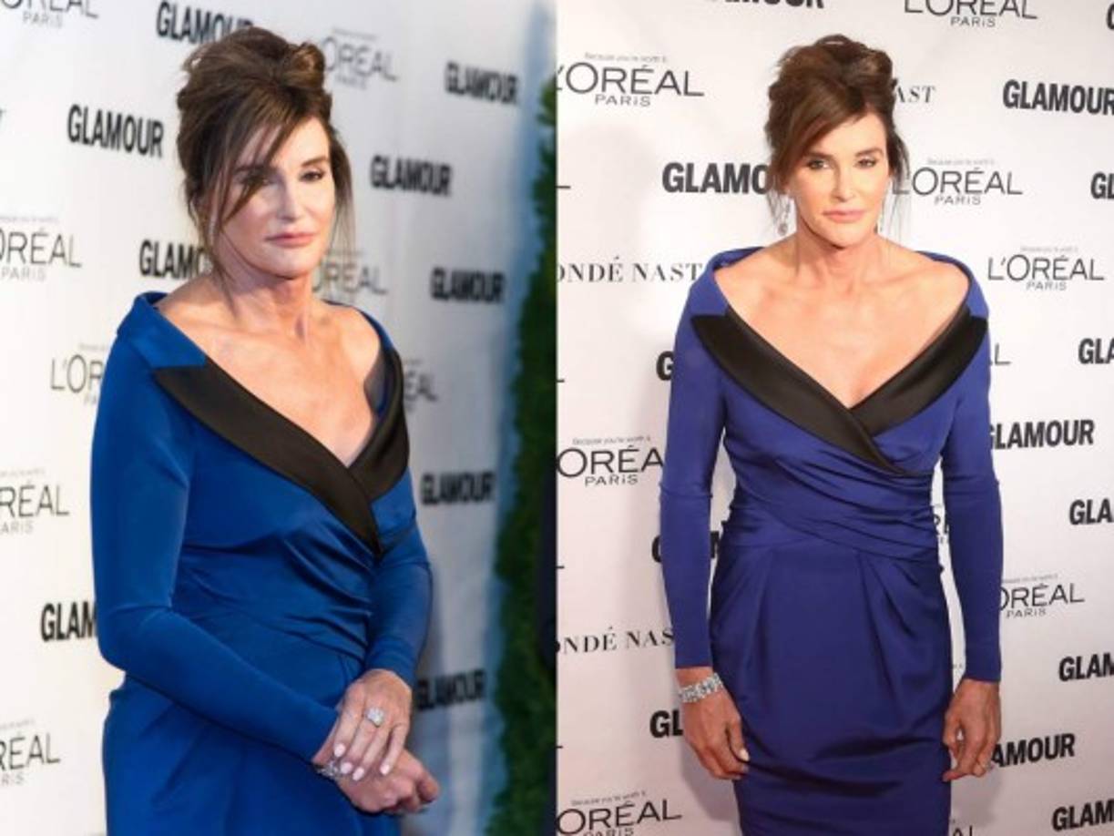 Vestida con un impresionante vestido azul klein de Moschino, Caitlyn demostró que, además, se ha convertido en musa de los creadores de alta costura.