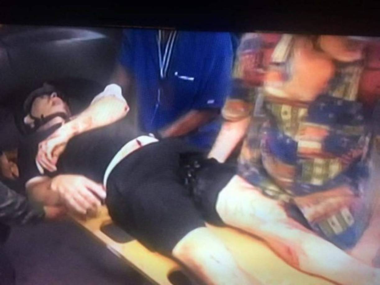 Momento cuando lo llevaban herido al artista hondureño asesinado.