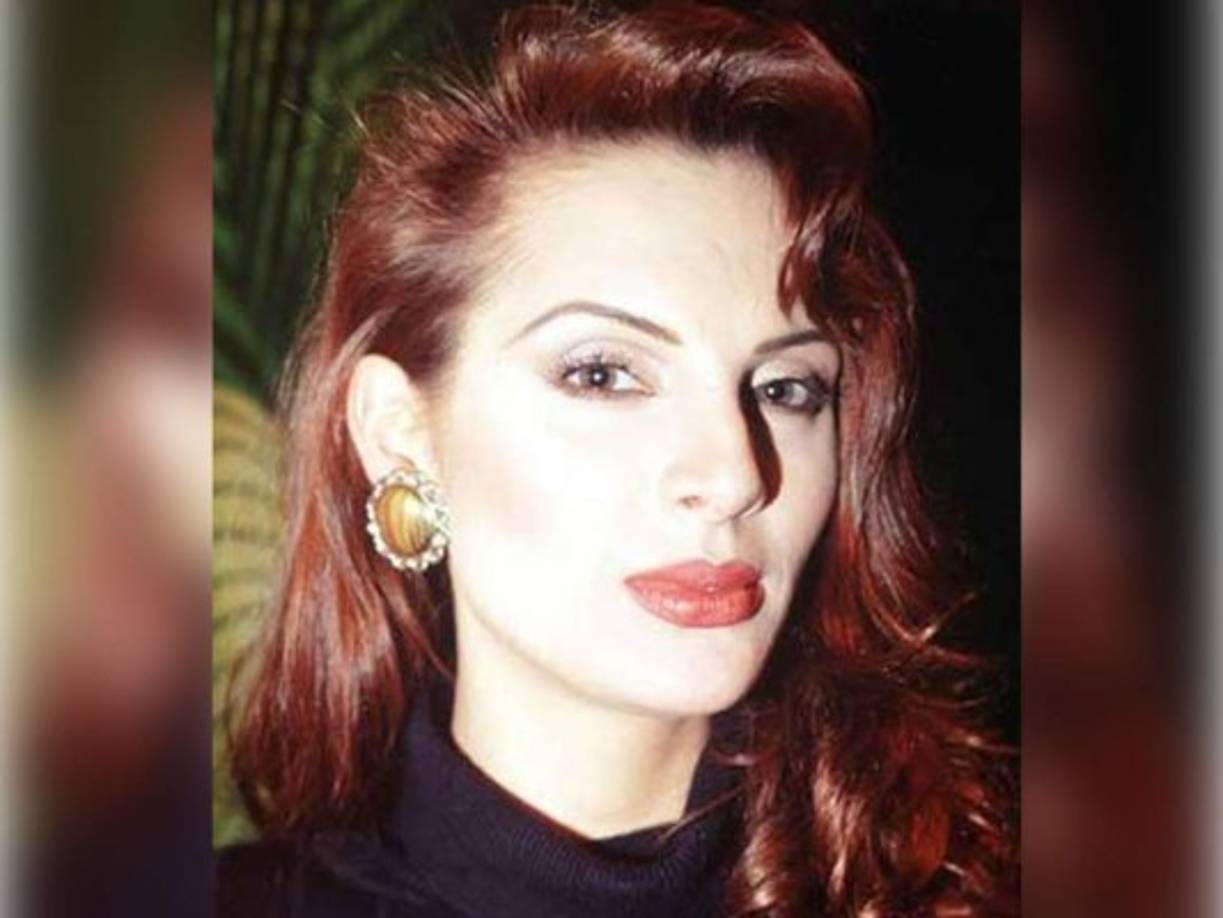 El origen de su deformación nasal, según su versión, se debe una bacteria adquirida, supuestamente por culpa de una empleada, al comer carne podrida.<br/><br/>Aunque es es sabido que la deformación nasal fue una consecuencia del consumo drogas.