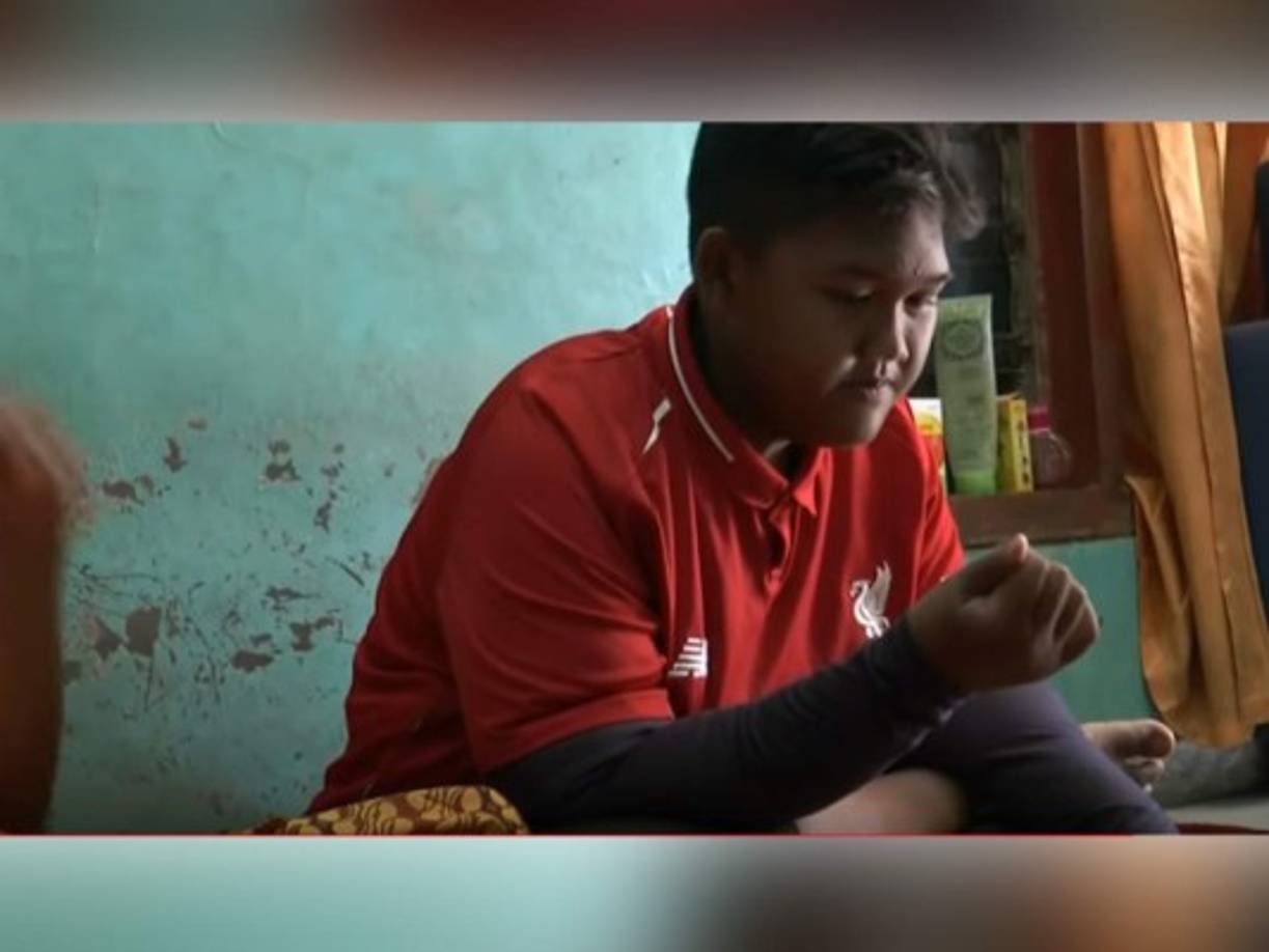 El menor indonesio ya ha perdido 220 libras y luce irreconocible.