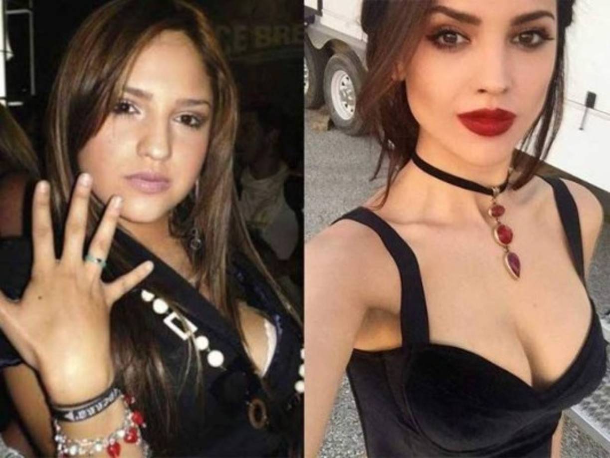¿Con o sin bisturí?. Aunque son pocas las que han aceptado haber pasado por el quirófano, a continuación veremos la transformación que han atravesado algunas famosas actrices mexicanas frente al ojo público. 1. Eiza Gonzalez: Algunos la señalan como adicta a las cirugías sin embargo la actriz solo ha aceptado una rinoplastía ya que le pareció 'evidente' el cambio.