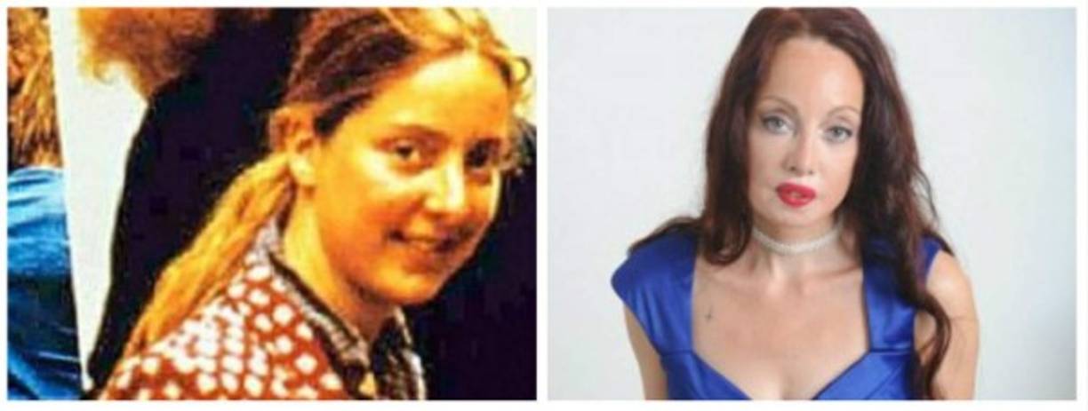 Para lograr asemejarse a Nefertiti, Namita se ha operado la nariz, los ojos, se ha realizado injertos de mentón y estirado la piel de su rostro. En la imagen de la izquierda, la británica antes de someterse a las cirugías estéticas.