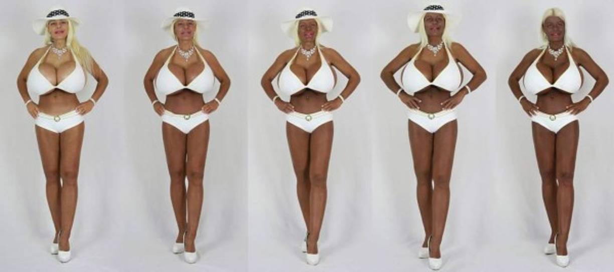 También asegura haber tenido 'inyecciones de melanina' para lograr un color más oscuro.