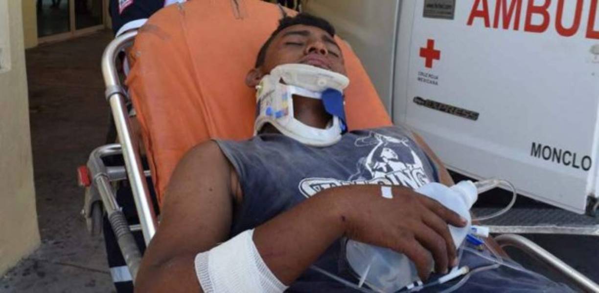 Por plato de comida lanzan a hondureño migrante de La Bestia. Un hondureño migrante, menor de edad, que viajaba a bordo de 'La Bestia', fue lanzado cuando el tren iba en movimiento por otros viajeros tras discutir por algo de comida, según información brindada este martes por medios mexicanos. El joven fue identificado como Nervin Enrique Fernández Castellanos (17) quien en su delirio de dolor daba gracias a Dios de no haber muerto mutilado por las ruedas del tren. Fernández Castellanos se estrelló con la superficie de piedras y rieles que se ubican en el crucero ferroviario de Estación Hermanas y al caer se golpeó en la cabeza, el rostro y un brazo.