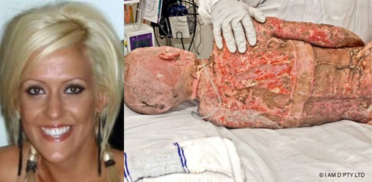 Natalie acusó equivocadamente a Dana de tener una aventura con su marido.<br/>Pero cuando Vulin intentó explicarle que todas esas ideas estaban en su cabeza, Dimitrovska no la escuchó, le roció alcohol y le prendió fuego. <br/><br/>