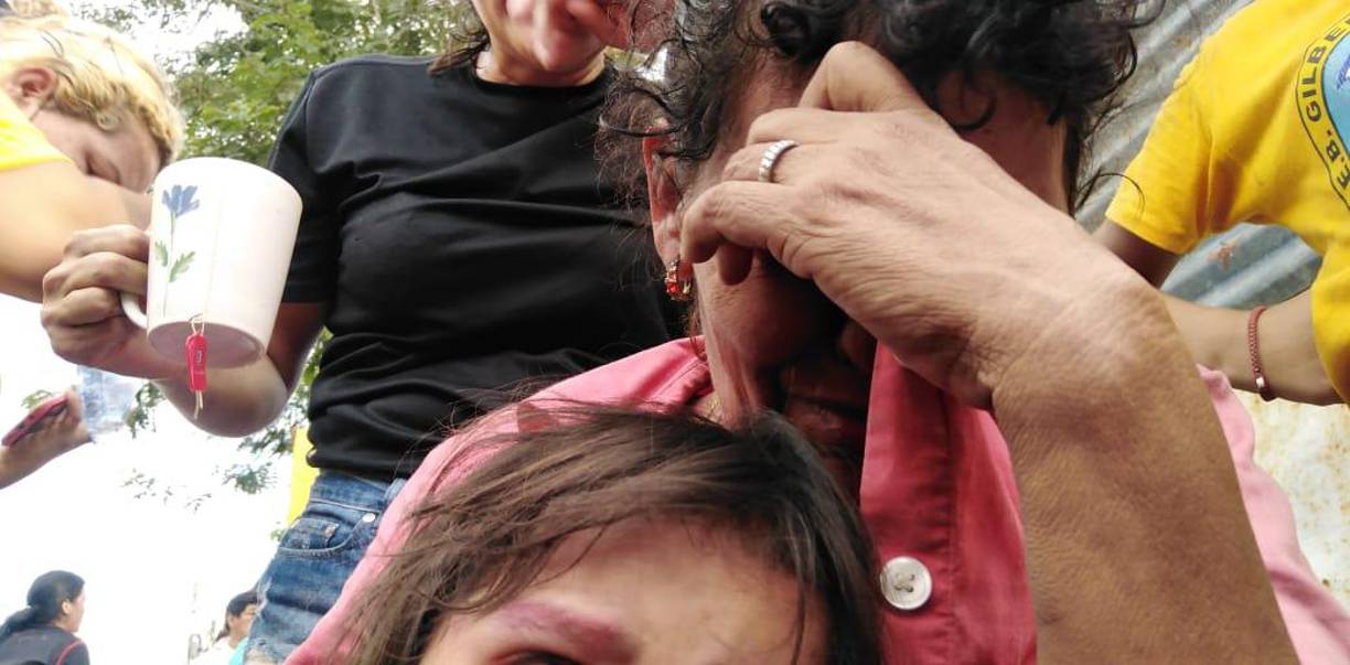 ¡Perdieron todo! Familias sampedranas quedan en la calle tras fuerte incendio