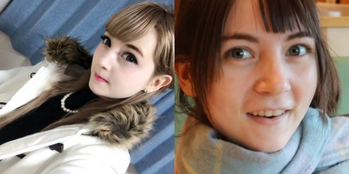 Mucho cirujanos se negaron a operar a Venus, sin embargo un galeno de Corea del Sur, de nombre Sehoon Kang, aceptó. <br/><br/>