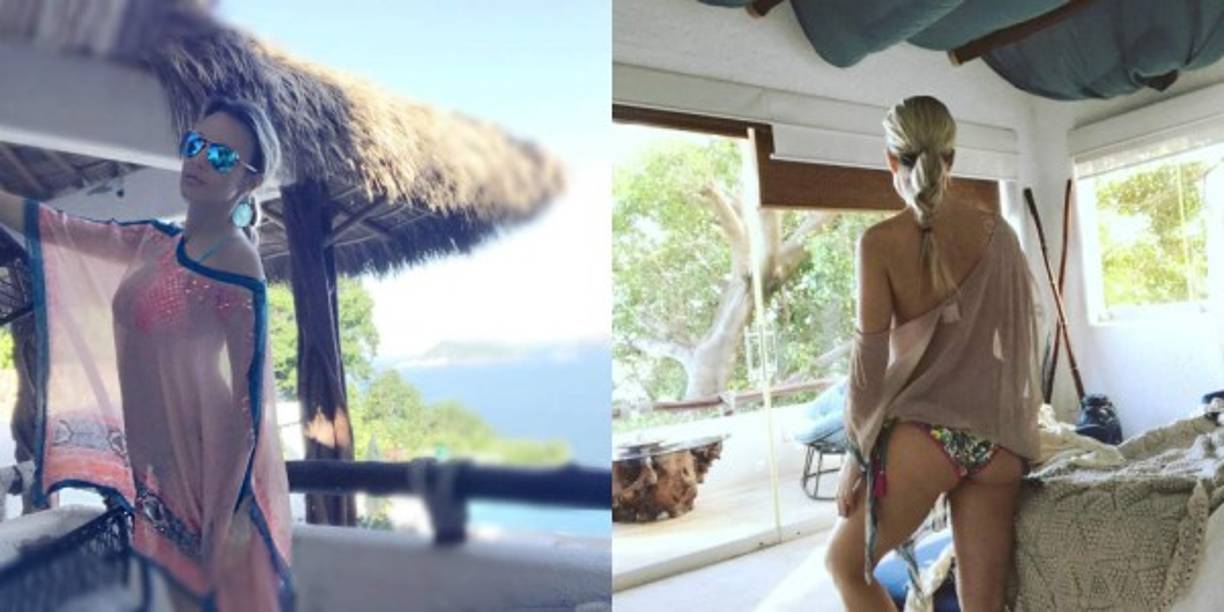 En su cuenta de Instagram, la artista compartió con sus seguidores algunas de las imágenes que se hizo en estos días de reposo y generó cientos de comentarios.<br/>