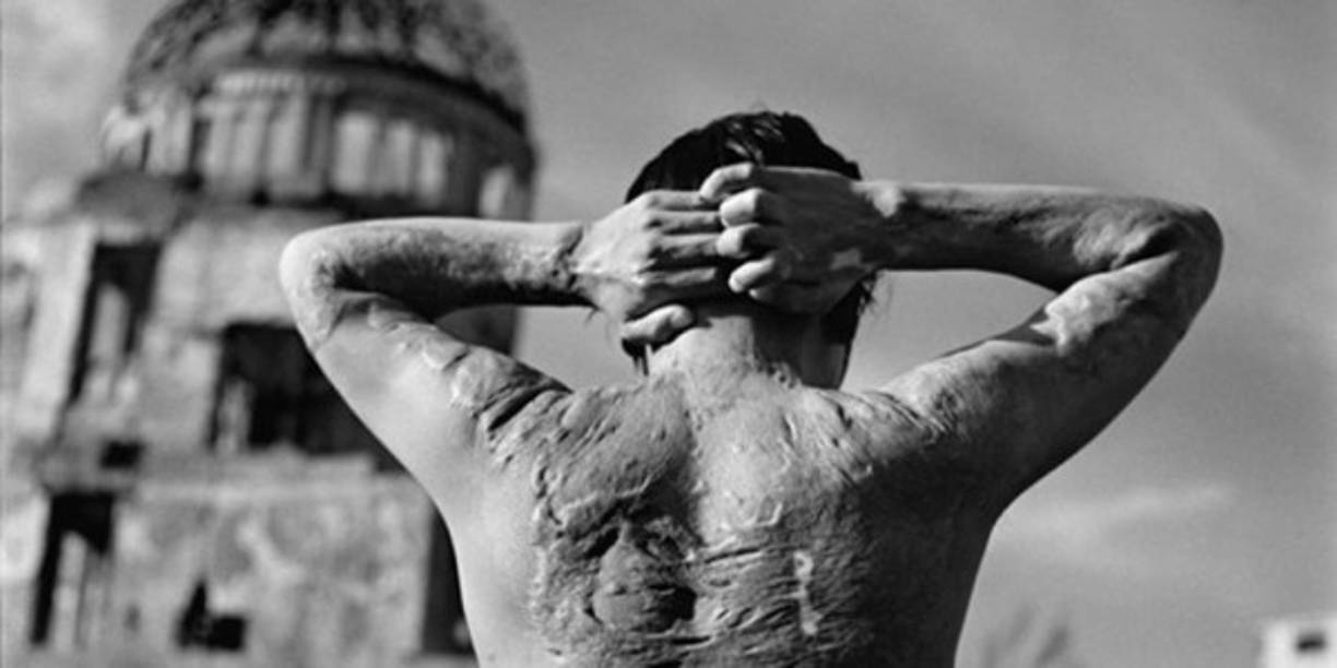 Entre las enfermedades atribuidas a las bombas que aparecieron después de 1945 figuran la leucemia o el cáncer.