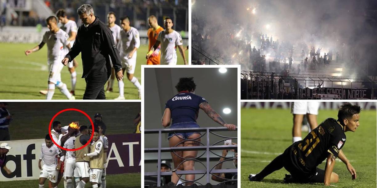 Las imágenes que dejó el partido de ida de la final de la Liga Concacaf que perdió el Motagua (1-2) contra el Comunicaciones de Guatemala en el estadio Nacional de Tegucigalpa.