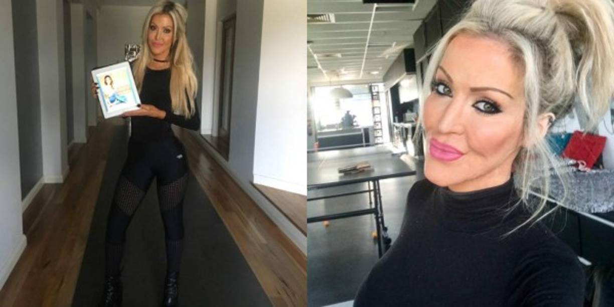 Cuando se le preguntó que siente respecto a su agresora, Dana dijo:<br/>'Aprendí cuando era muy joven a no odiar, y estoy muy contenta de haber aprendido esa lección antes de quemarme porque el odio es tan tóxico en la mente y el cuerpo y esto podría haber sido un viaje completamente diferente si no hubiera aprendido esa lección.<br/><br/>Sólo centrar mi energía en ser positivo y mi recuperación y ayudar a otras personas.<br/><br/>¿Quién tiene tiempo para odiar? Odiar es estúpido. Nadie gana.'<br/>