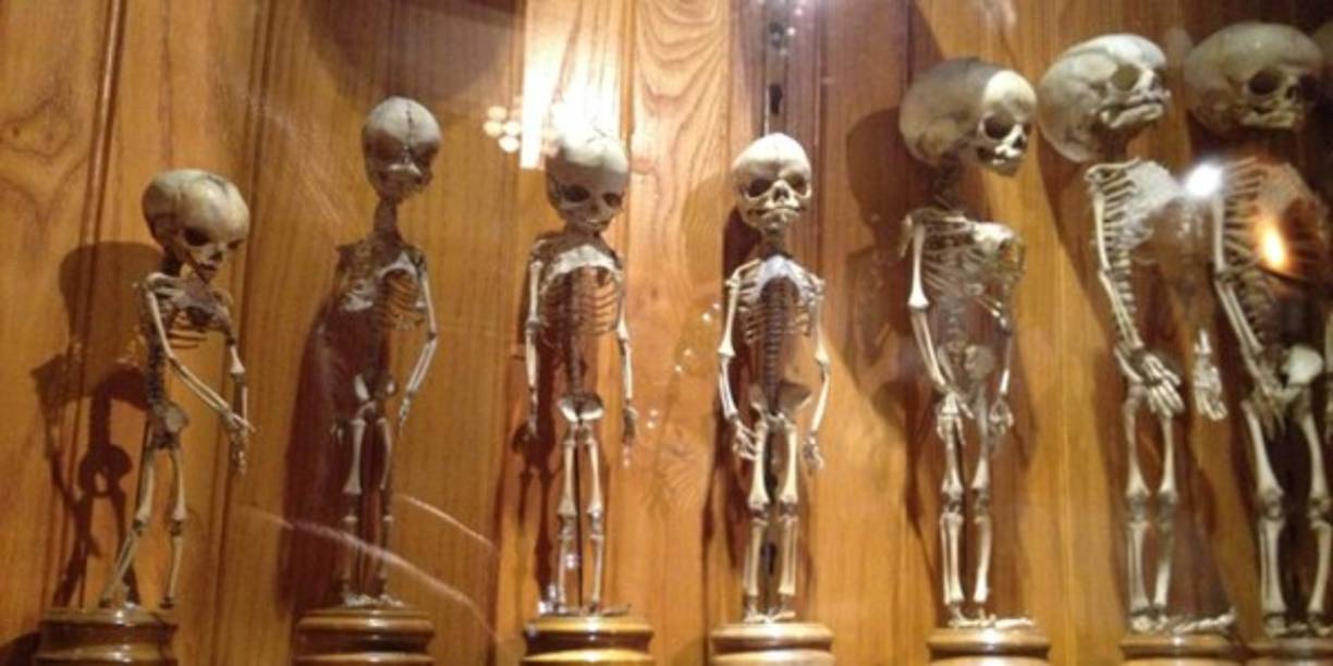 El museo de Mütter se encuentra en Pensilvania, Estados Unidos, éste terrorífico lugar expone cráneos deformados,exhibiciones disecadas de órganos humanos y frascos llenos de piel humana. Foto:elviajerofeliz.com