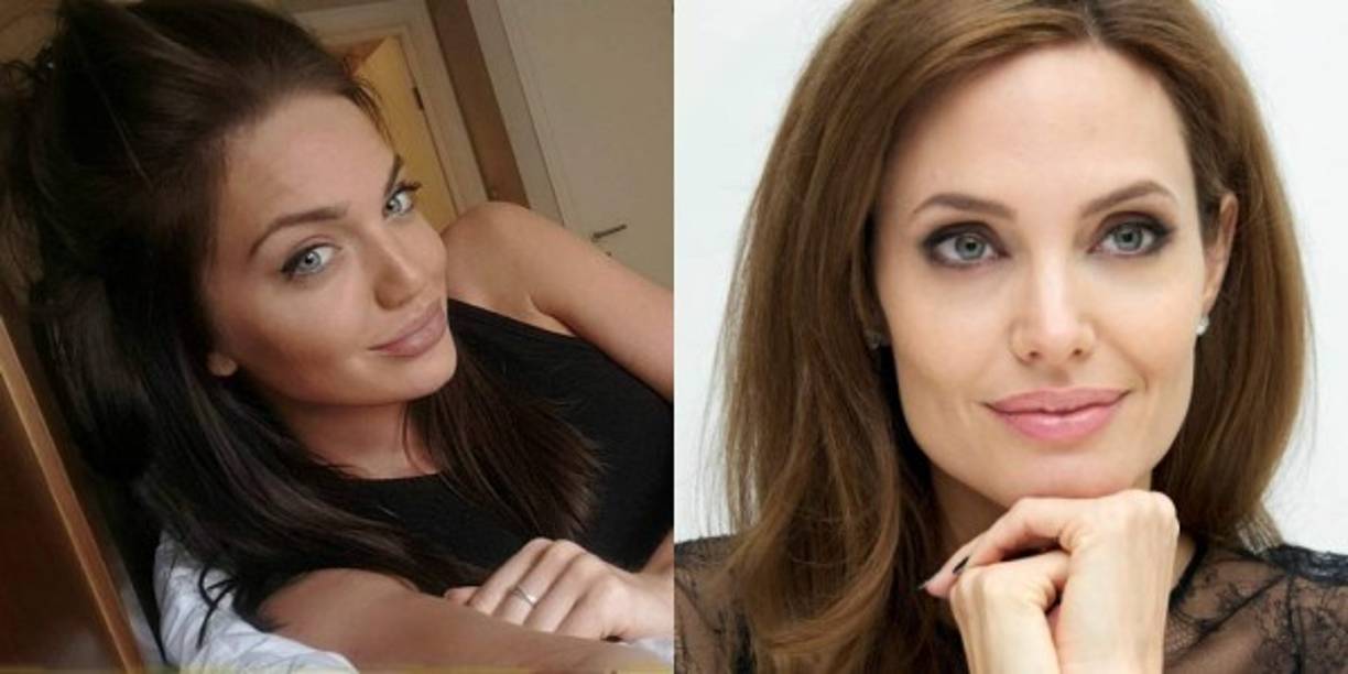 Chelsea admitió haberse operado los pechos, la nariz y los labios, “al igual que muchas otras mujeres”, pero que en ningún momento lo hizo para parecerse a otra persona.