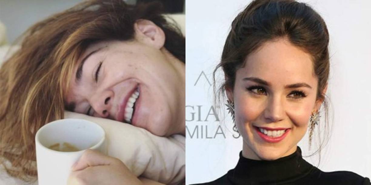 La imagen publicada en su Instagram Stories muestra las imprefecciones en su cara.<br/>“Es mi cara para toda la vida” escribió.<br/>