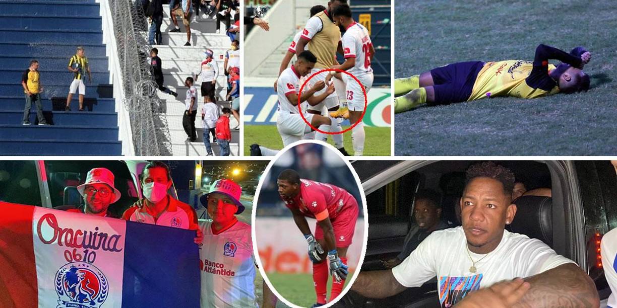 Las imágenes que dejó el primer partido de la final del Torneo Apertura 2021 que ganó el Olimpia (2-0) al Real España en el estadio Nacional con doblete de Jorge Álvarez.