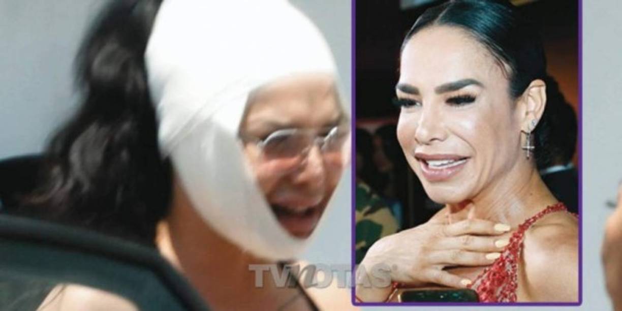 Lis Vega decidió cambiar su rostro y físico, para eso se sometió a dolorosas cirugías.