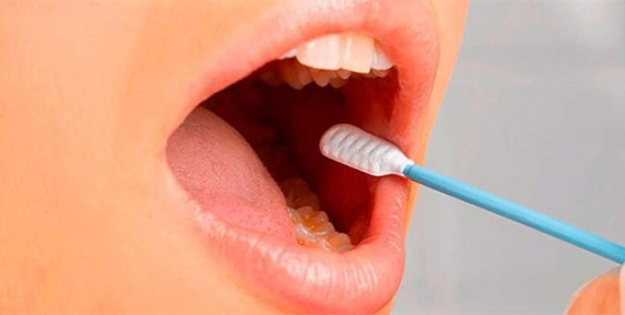 El agua oxigenada en un compuesto químico con propiedades antibacterianas es uno remedios populares para el dolor de muelas