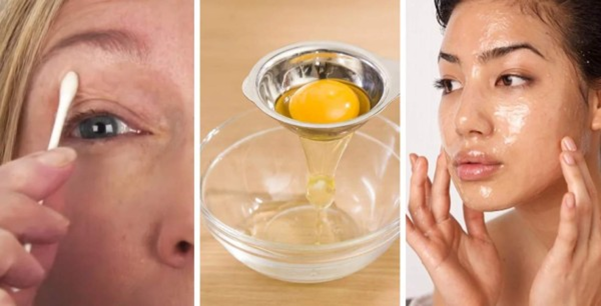 9. Con huevo puede hacerse una rápida máscara que le ayude a sacar el brillo aceitoso de su rostro.