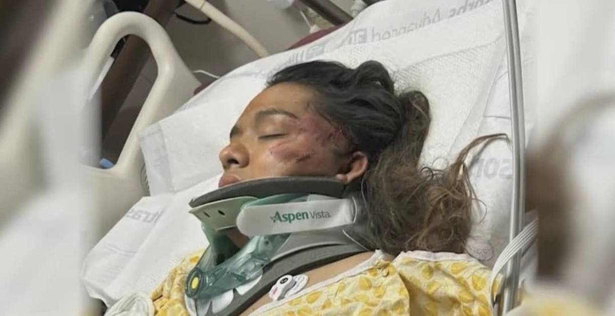 Armando escapó con heridas leves, pero le dijo a medios locales que su hijo pequeño y su esposa están gravemente heridos.