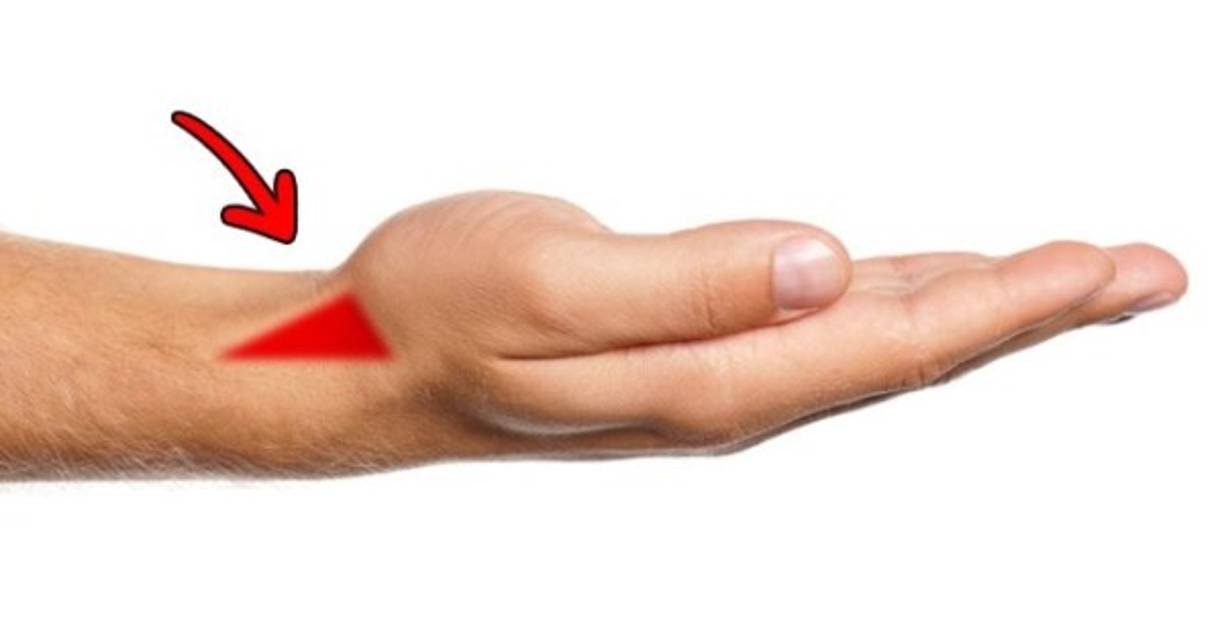 Si enderezas y giras un poco el dedo pulgar de la mano, en su base aparecerá un hoyuelo en forma de triángulo. Esta parte del cuerpo se llama la tabaquera anatómica, ya que en el pasado la gente la usaba para colocar y consumir el tabaco.<br/><br/>Precisamente por este punto pasa la arteria radial, la cual siempre es fácil de ubicar incluso si la pulsación no es muy fuerte. Y todo porque en esta zona la arteria solo está cubierta de piel y un tejido conectivo.