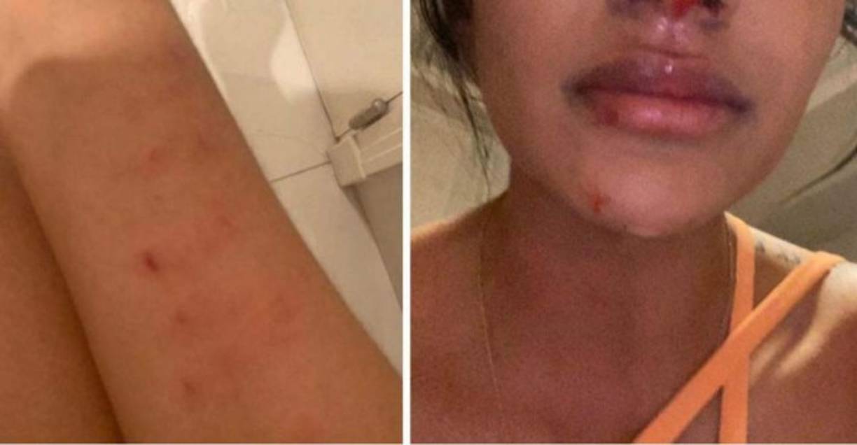 Daniela Cortés, exnovia del jugador Sebastián Villa, también denunció que perdió un embarazo por los maltratos físicos y agresiones del actual futbolista de Boca Juniors.