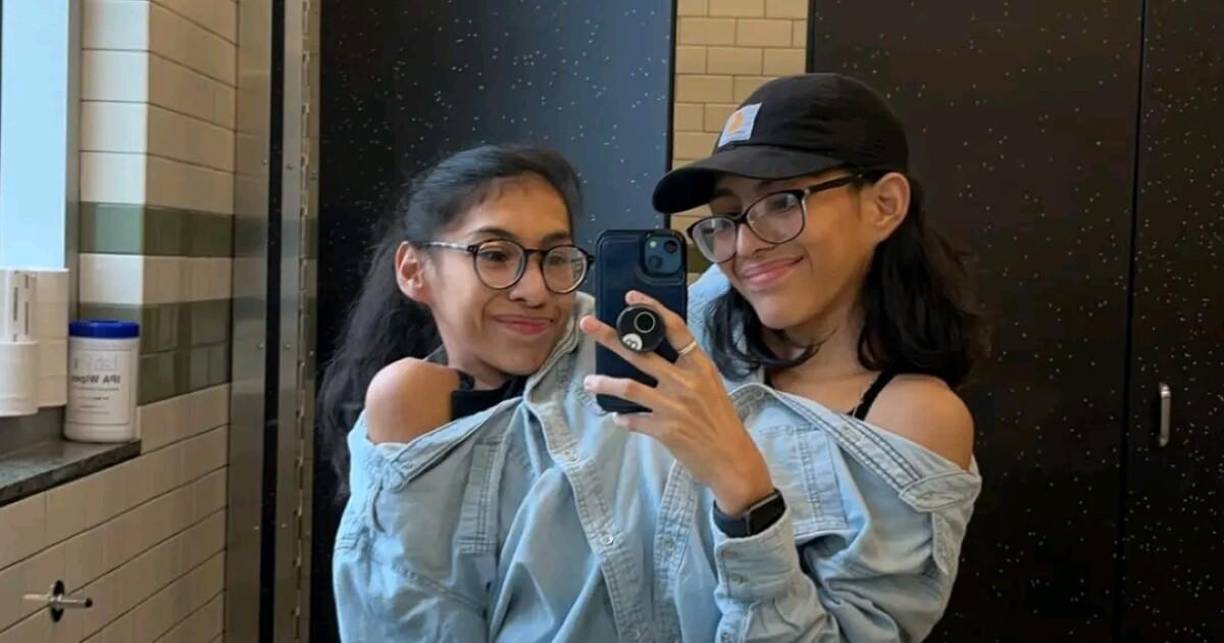 Nacidas en México, llegaron a Estados Unidos junto a sus padres en el año 2002, con la esperanza de ser sometidas a una cirugía de separación que no logró ser ejecutada en su momento ni tampoco después.