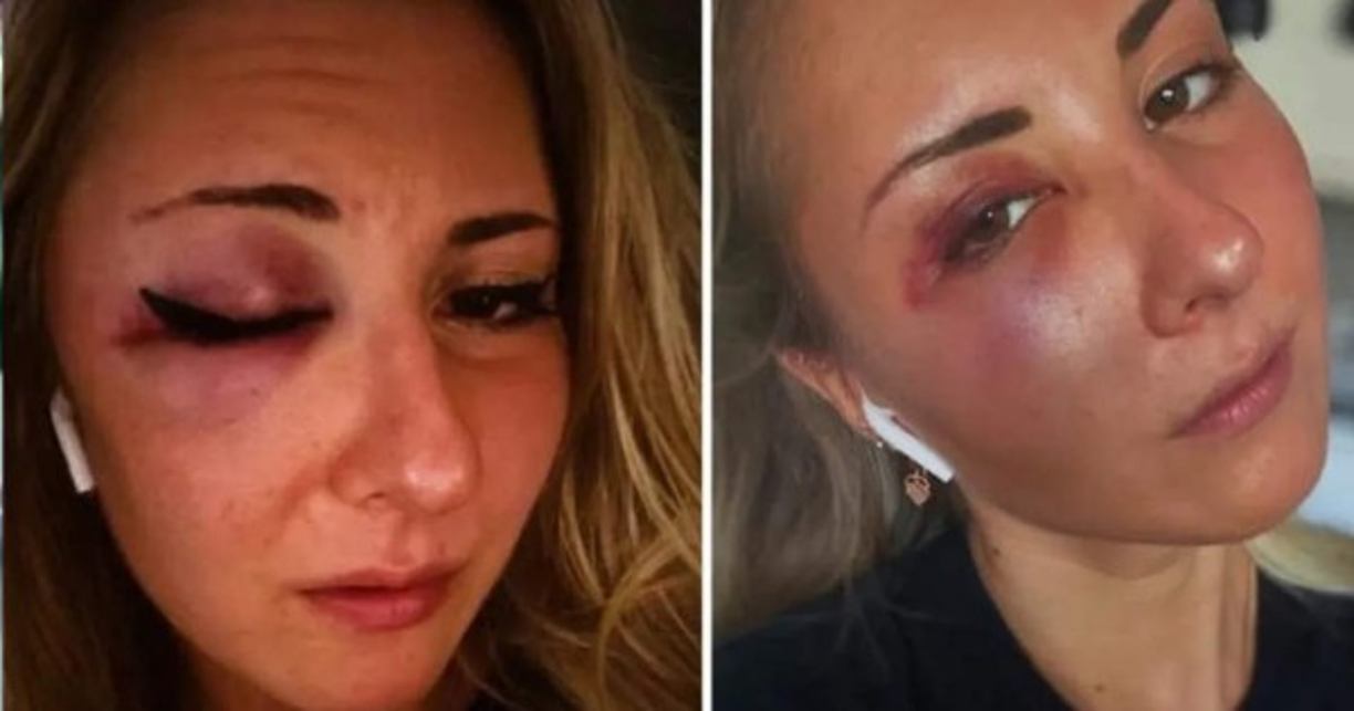 La policía francesa abrió una investigación después de que una joven dijera que fue insultada y golpeada por tres hombres a plena luz del día por llevar una falda. <br/><br/>