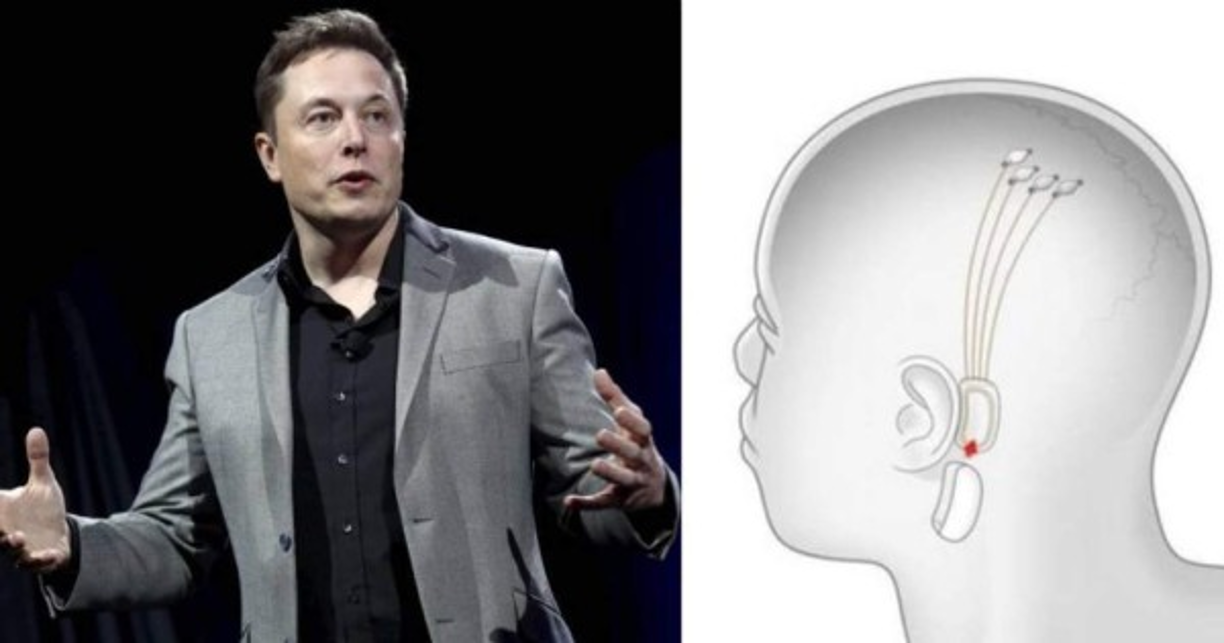 La empresa Neuralink, en la que Elon Musk, el propietario de la fabricante de automóviles Tesla y la compañía espacial SpaceX, es el socio principal, ha probado con éxito en cerdos un chip que implantado en el cráneo permite medir la actividad cerebral, pero va a tener muchas más aplicaciones.