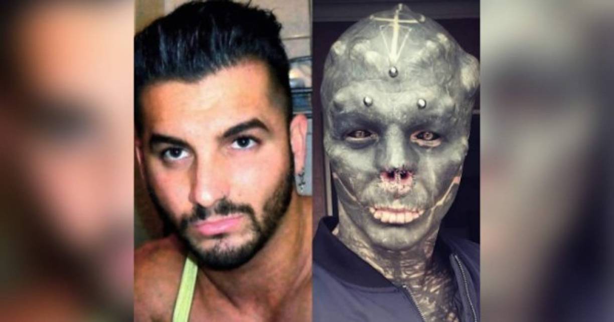 Solo lleva un 25% de su transformación, o eso asegura Anthony Loffredo, un hombre quien quiere convertirse en un verdadero alienígena. Y, para ello, la última operación que se ha hecho ha sido para quitarse la nariz.<br/><br/>