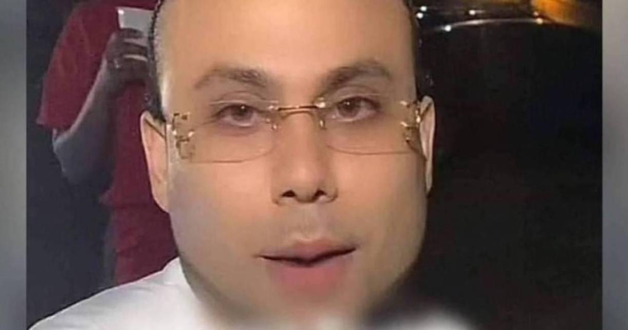 Reyes también mostró las heridas de la golpiza en sus manos.