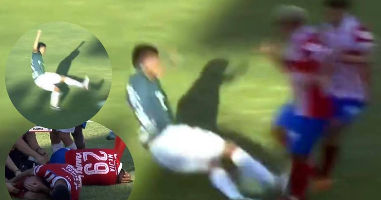 La dura falta de André Orellana ha trascendido fronteras. 