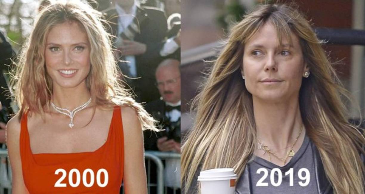 La única diferencia que se puede apreciar entre ambas instantáneas son las pequeñas arrugas que ahora se le forman al lado de los ojos al sonreír y que no le restan ni un mínimo de atractivo.<br/>