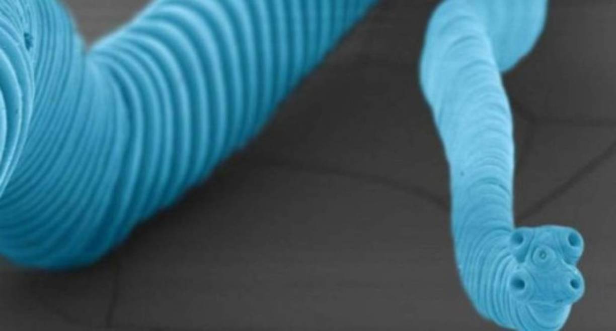 Solitaria. Un caso reciente de un hombre que murió de cáncer transmitido por una solitaria ha llamado la atención sobre este parásito. Pueden vivir dentro de una persona durante meses, años incluso, antes de que sean detectados.