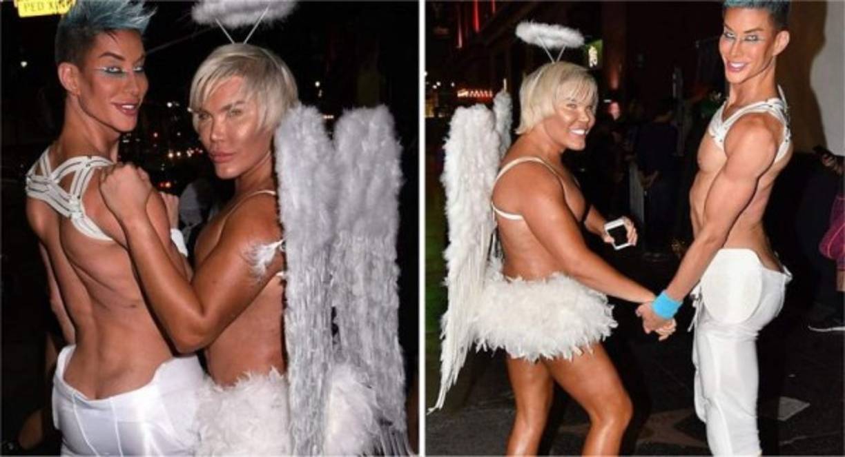 29 mil dólares definitivamente suena como mucho dinero. Y lo es. Y si quieres gastarlo en implantes de abdominales porque quieres ser igual a un muñeco Ken ¿quién soy yo para detenerte? Rodrigo Alves, más conocido como el Ken Humano, se sometió a un nuevo proceso quirúrgico que le dejó un six pack de abdominales…