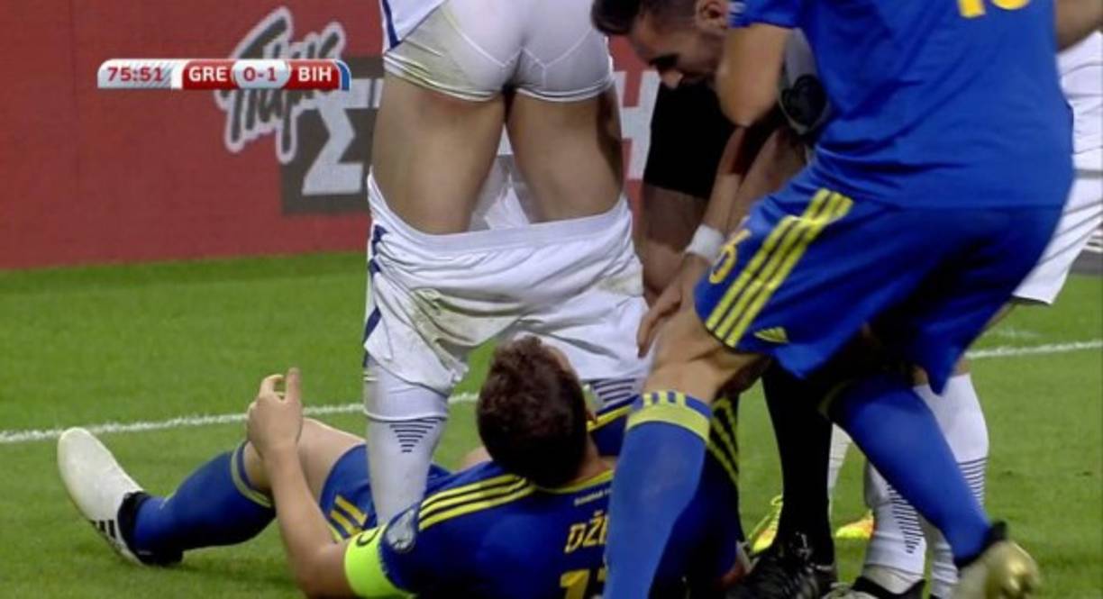 La jugada terminó con una amarilla para cada jugador y Dzeko abandonando el partido expulsado al ver antes una tarjeta amarilla.