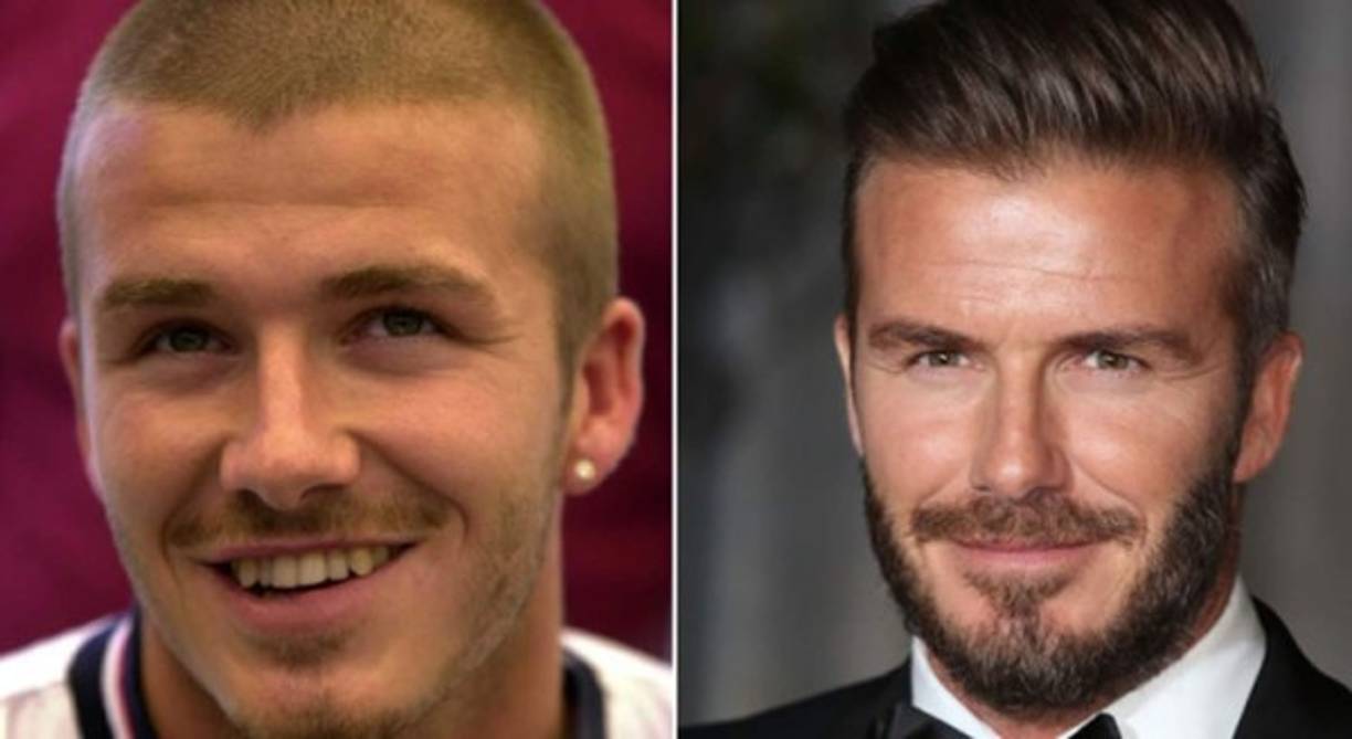 David Beckham se hizo un pequeño arreglo en la nariz y en los dientes.