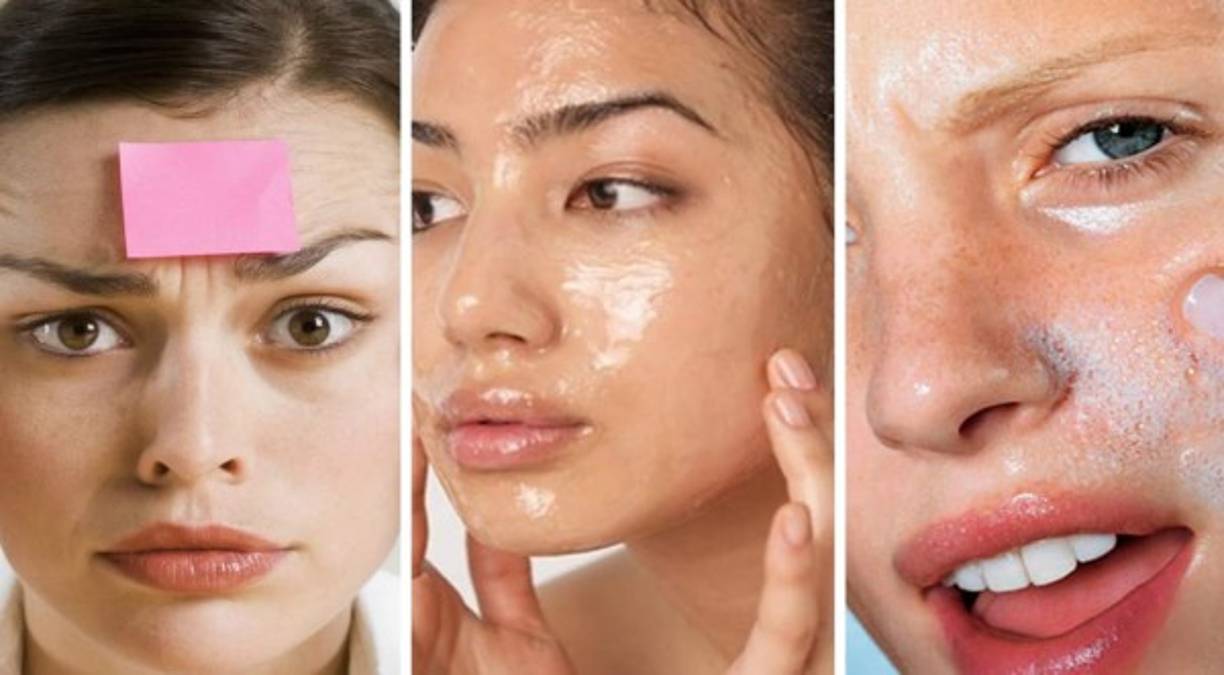 Para algunas personas tener el cutis grasoso es toda una molestia. Sin embargo, esto no debería quitarle el sueño ya que existen diferentes remedios que pueden ayudarle a controlar este problema.<br/><br/>Muchos factores contribuyen a este tipo de piel, incluyendo los niveles hormonales, la humedad, la dieta y los cosméticos. Sin embargo, el factor hereditario juega el papel principal en la producción de grasa.